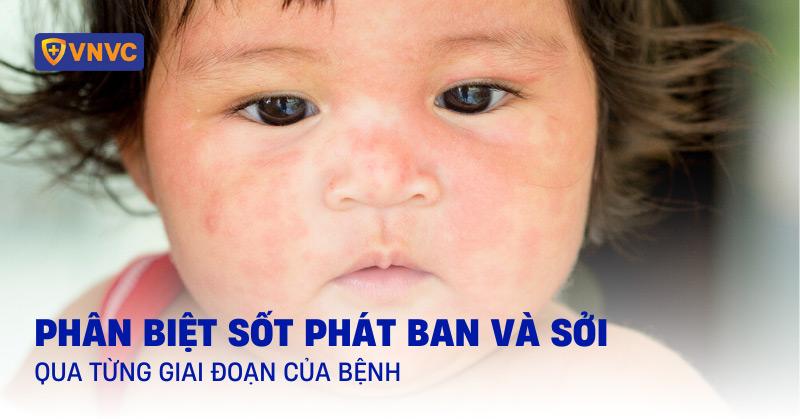 Hinh dang va dac diem nhan biet cua tom phoc